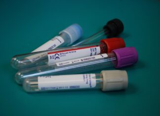 Mednarodna kolesarska zveza zagovarja nočna testiranja: boj za poštenost v kolesarstvu