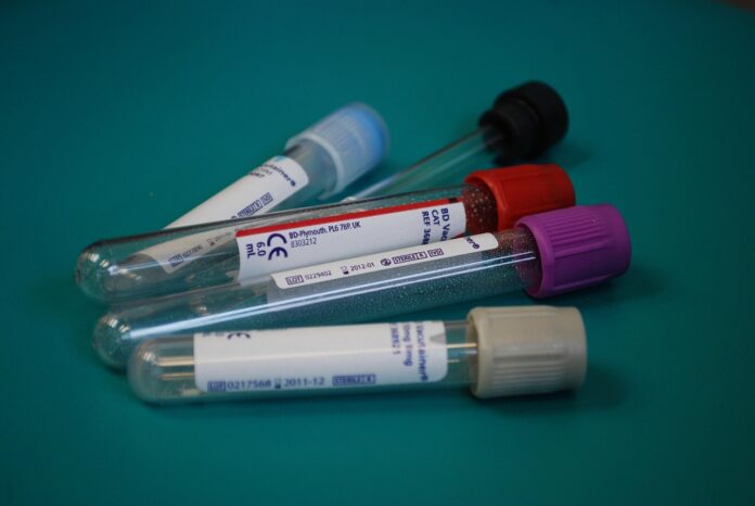doping-test