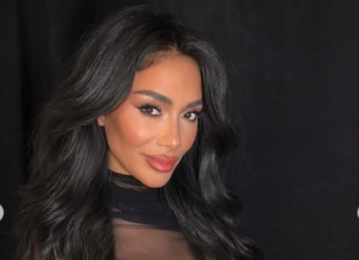 Le uro pred koncertom jo je opekla vrela voda: Nicole Scherzinger kljub poškodovani nogi stopila na oder #foto